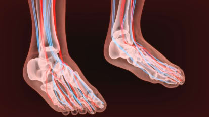 Limb Preservation for Patients with Diabetic Foot Ulcers