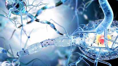 #TomorrowsDiscoveries: The Effects of Huntington’s Disease