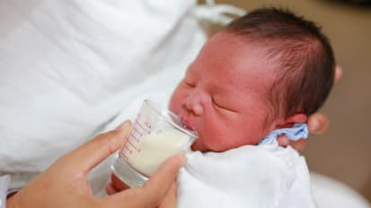 Standardized Feeding Reduces Cholestasis in Surgical Neonates