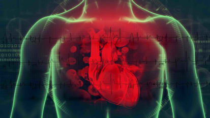 Case Presentation: Transcarotid Artery Revascularization