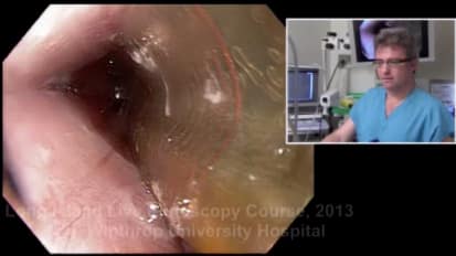 2013 LI Live Endoscopy Course: Live Afternoon Procedures Part 2