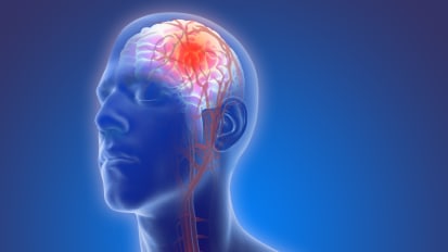 Motor Stroke Research Lab and Stroke Institute Updates