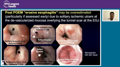 Lecture: Submucosal Endoscopy & NOTES. US Perspective