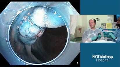 2018 LI Live: Live Endoscopic Procedures - Afternoon Part 2 of 2