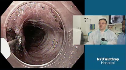 2018 LI Live: Live Endoscopic Procedures - Morning Part 1 of 2