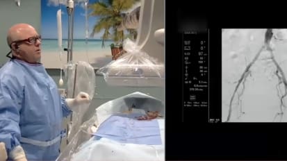 PAD crossing conundrum: Expert tips for PAD interventions with Philips IVUS and laser atherectomy