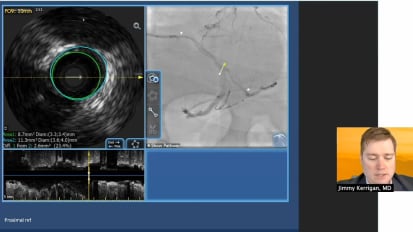 IVUS guided stent optimization case review with Dr. Jimmy Kerrigan