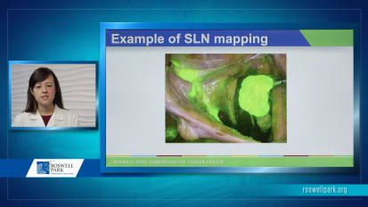 Sentinel Lymph Node Mapping in Endometrial Cancer