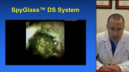 No Stone Left Unturned: Difficult Stone Management Techniques and Clinical Perspective, by Mouen Khashab, MD, Johns Hopkins Hospital, Baltimore, Maryland, U.S.A.