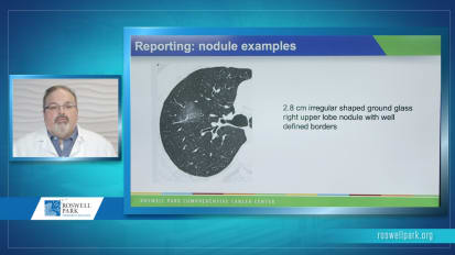 Practical Aspects of Lung Cancer Screening for the Radiologist 