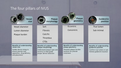 IVUS four pillars PAD