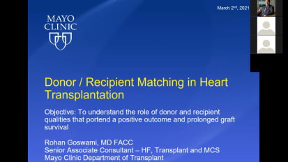 Donor selection strategy for heart transplantation
