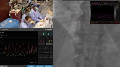 Ultra-low contrast PCI case studies in high-risk patients: Techniques and tools to optimize outcomes