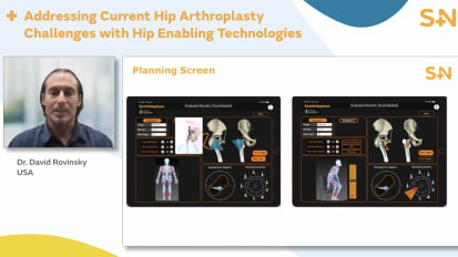 The Role of Enabling Technologies in Current Hip Arthroplasty Challenges