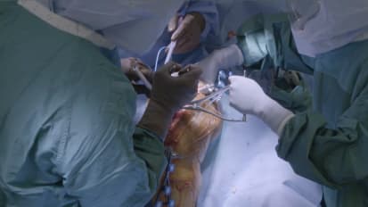Live Surgery: Robotic-assisted TKA featuring JOURNEY™ II ROX™ Total Knee System