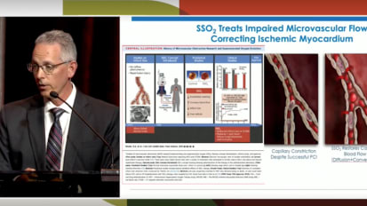 Cardiogenic Shock and the Role of Mechanical Support