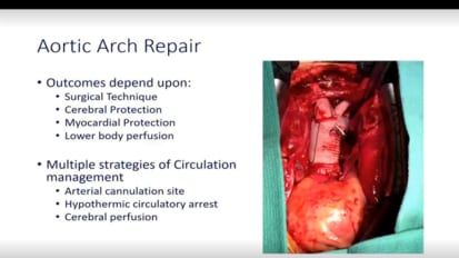 Cutting Edge Surgical Options for Aortic Disease