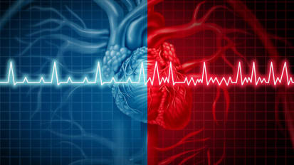 Heart Rhythm Webinar Series: Challenging case discussion with Mayo Clinic experts on genetic testing and rhythm disorders