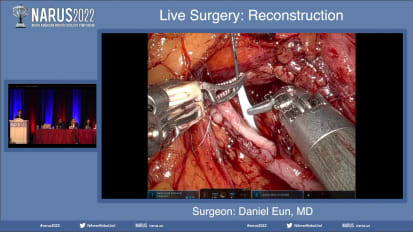 LIVE Case: Buccal Mucosa Graft Ureteroplasty