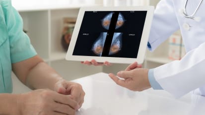 Breast MRI and Advanced Breast Intervention