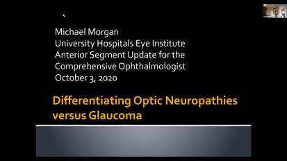 Differentiating Optic Neuropathies vs. Glaucoma