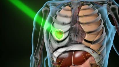 ViewRay MR-Linac: First in World at Henry Ford Cancer Institute (HFCI)!