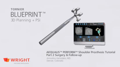 Clinical Use of BLUEPRINT™ on a B3 Glenoid - Part 2 Surgery and Follow-up - Armodios Hatzidakis, MD [CAW-2821]