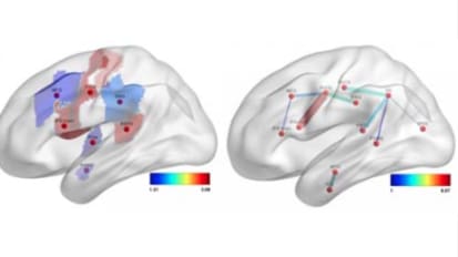 Predicting Language Deficits after Stroke with Connectome-Based Imaging