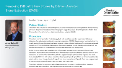 Removing Difficult Biliary Stones by Dilation Assisted Stone Extraction (DASE) by Jeremy Barber, D.O.