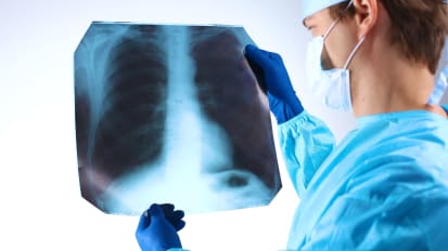 Lung Transplant Program