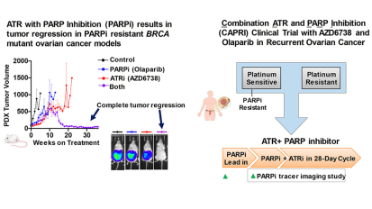 Enrolling Clinical Trials: Combination ATR and PARP Inhibitor (CAPRI) Trial With AZD6738 and Olaparib in Recurrent Ovarian Cancer