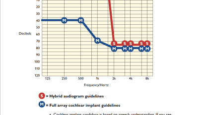 Cochlear Implant and Hybrid Implant Candidacy