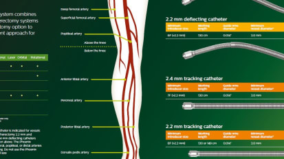 Phoenix Atherectomy System ATK BTK Poster