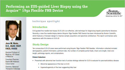 Performing an EUS-guided Liver Biopsy using the Acquire™ 19ga Flexible FNB Device by Jose M. Nieto, D.O., UCF School of Medicine, Jacksonville, Florida, U.S.A.