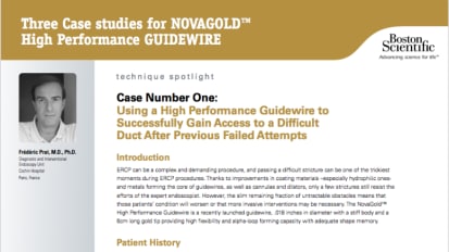  Three Case studies for NOVAGOLD&trade; High Performance GUIDEWIRE
