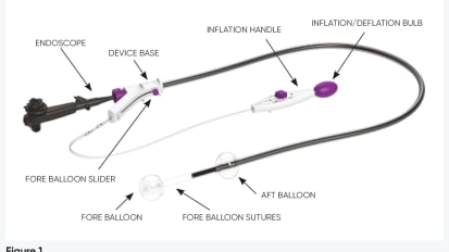 The Cost-Effectiveness of DiLumen™ for Endoscopic Intervention of Complex Colonic Polyps