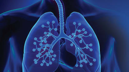 Thoracic Oncology