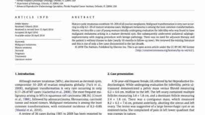 Malignant melanoma arising in a mature teratoma: A case report with review of the recent literature