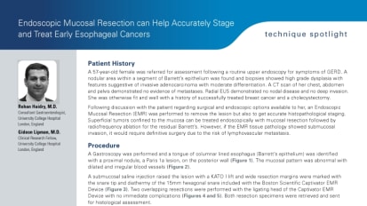 Endoscopic Mucosal Resection can Help Accurately Stage and Treat Early Esophageal Cancers, Rehan Haidry, MD