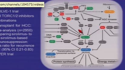 Systemic Therapy for Advanced Hepatocellular Carcinoma Angela Alistar, MD 