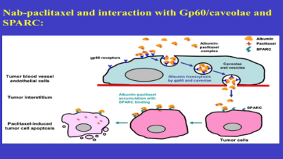 New Paradigms in Treatment of Pancreatic Cancer Angela Alistar, MD 