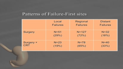 Chemoradiation for Gastric Cancer: Indications and Outcomes William Blackstock, MD 