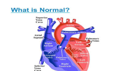 Basics of Congenital Heart Disease