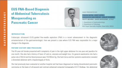 EUS FNA-Based Diagnosis of Abdominal Tuberculosis Masquerading as Pancreatic Cancer