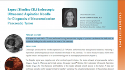 Expect Slimline (SL) Endoscopic Ultrasound Aspiration Needle for Diagnosis of Neuroendocrine Pancreatic Tumor