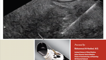 Introduction to Endoscopic Ultrasound Fine Needle Aspiration (EUS-FNA) Sampling Techniques Presented by Mohammad Al-Haddad, M.D.