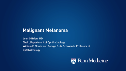 Malignant Ocular Melanoma