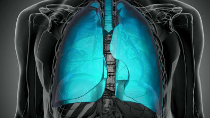 Lung Cancer: Do you think you have anything to offer? 