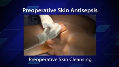 Skin Prep & Wound Draping - Steve Wilson, MD