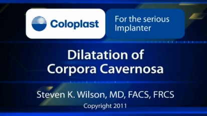 Dilatation of Corpora Cavernosa